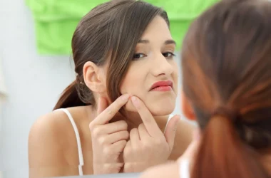 How to Remove Pimples Naturally and Permanently