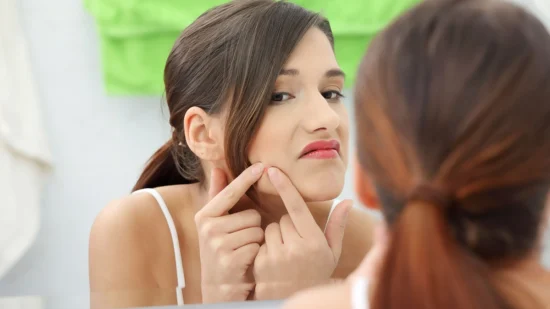 How to Remove Pimples Naturally and Permanently