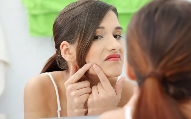 How to Remove Pimples Naturally and Permanently